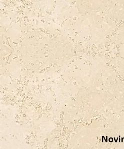 تراورتن حاجی آباد سورت ۲